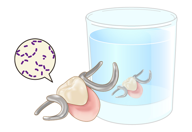 寝るときの入れ歯の保管