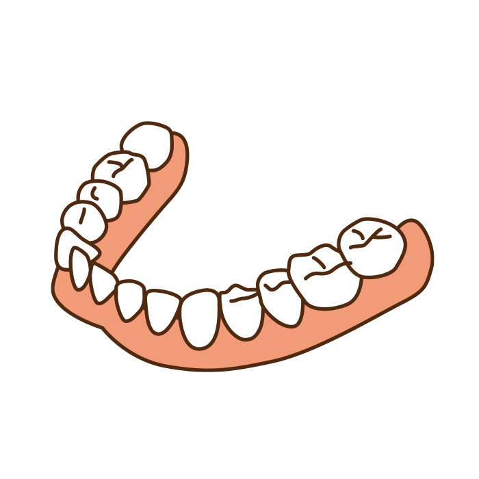 試作の入れ歯を製作します